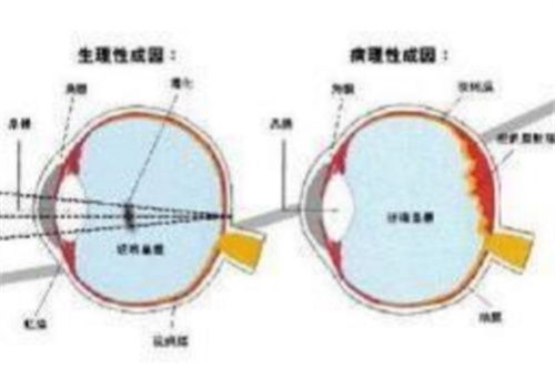 闭眼时，感觉有小黑影飘动是啥情况？南昌洪城爱尔眼科医院告诉你