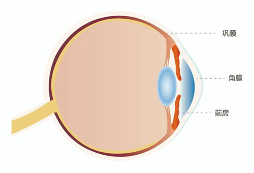 角膜炎有哪些症状？看看你中招没，如何预防角膜炎？